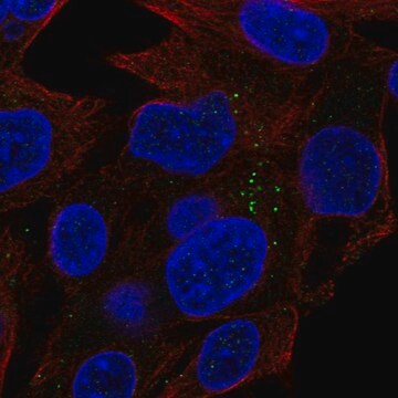 Anti-Acy1 Antibody Produced In Rabbit Prestige Antibodies&#174; Powered by Atlas Antibodies, affinity isolated antibody, buffered aqueous glycerol solution