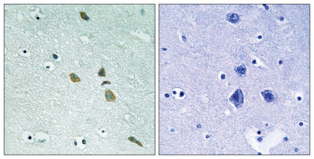 Anti-ILK antibody produced in rabbit affinity isolated antibody