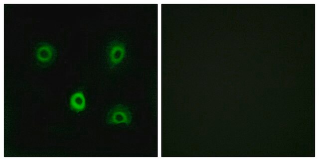 Anti-ABHD6 antibody produced in rabbit affinity isolated antibody
