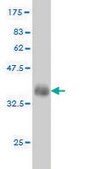 ANTI-FGR antibody produced in mouse clone 3B11, purified immunoglobulin, buffered aqueous solution