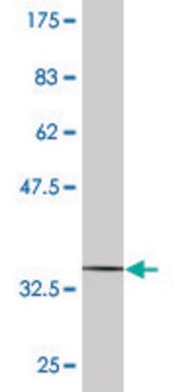 Monoclonal Anti-CDC42BPG antibody produced in mouse clone 2C3, purified immunoglobulin, buffered aqueous solution