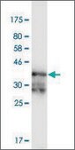 Monoclonal Anti-PRKAR2A, (N-terminal) antibody produced in mouse clone 3C7, purified immunoglobulin, buffered aqueous solution