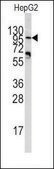 Anti-PYGM (center) antibody produced in rabbit Ig fraction of antiserum, buffered aqueous solution