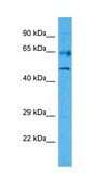 Anti-RARG antibody produced in rabbit affinity isolated antibody