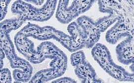 Anti-STAT6 Antibody, clone 1C13 ZooMAb&#174; Rabbit Monoclonal recombinant, expressed in HEK 293 cells