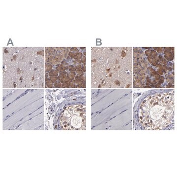 Anti-CARS antibody produced in rabbit Prestige Antibodies&#174; Powered by Atlas Antibodies, affinity isolated antibody, buffered aqueous glycerol solution