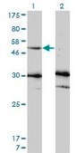 Monoclonal Anti-MMP13 antibody produced in mouse clone 3B11, purified immunoglobulin, buffered aqueous solution