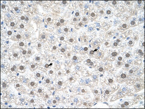 Anti-NR1I3 IgG fraction of antiserum