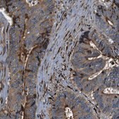 Anti-COL1A1 antibody produced in rabbit Prestige Antibodies&#174; Powered by Atlas Antibodies, affinity isolated antibody, buffered aqueous glycerol solution