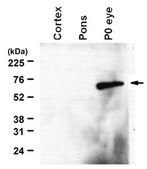 Anti-RalDH2 (ALDH1A2) from rabbit, purified by affinity chromatography