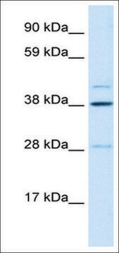 Anti-LASS3 antibody produced in rabbit affinity isolated antibody