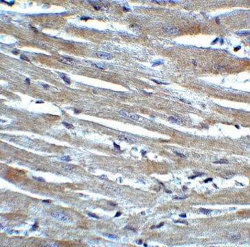 Anti-CX3CR1 antibody produced in rabbit affinity isolated antibody