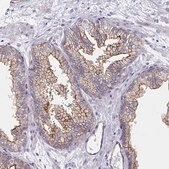 Anti-SSTR1 antibody produced in rabbit Prestige Antibodies&#174; Powered by Atlas Antibodies, affinity isolated antibody, buffered aqueous glycerol solution