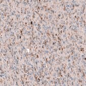 Monoclonal Anti-POSTN antibody produced in mouse Prestige Antibodies&#174; Powered by Atlas Antibodies, clone CL12087, purified immunoglobulin, buffered aqueous glycerol solution