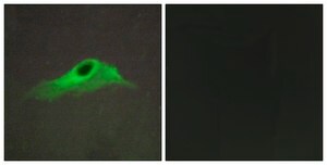 Anti-Collagen IV &#945;5 antibody produced in rabbit affinity isolated antibody