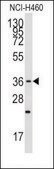Anti-CYP26A1 (center) antibody produced in rabbit saturated ammonium sulfate (SAS) precipitated, buffered aqueous solution