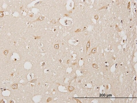 Anti-USP3 antibody produced in mouse purified immunoglobulin, buffered aqueous solution