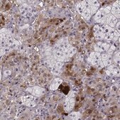 Anti-PNMT antibody produced in rabbit Prestige Antibodies&#174; Powered by Atlas Antibodies, affinity isolated antibody, buffered aqueous glycerol solution