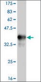 ANTI-TLR9 antibody produced in mouse clone 2C3, purified immunoglobulin, buffered aqueous solution