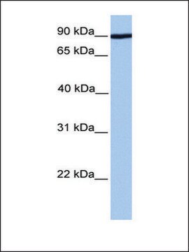 Anti-ADAM2 antibody produced in rabbit affinity isolated antibody