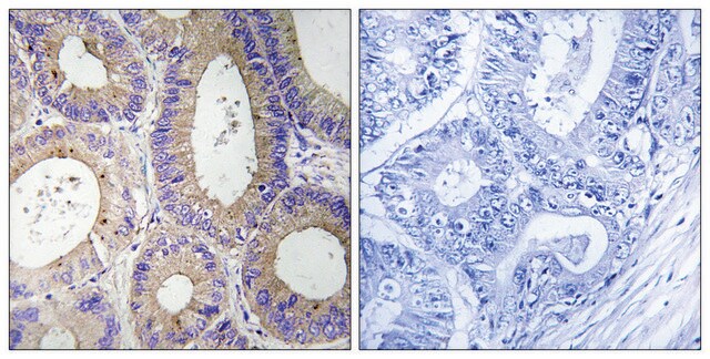 Anti-CBR3 antibody produced in rabbit affinity isolated antibody