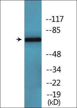 Anti-phospho-CaMK2-&#946;/&#947;/&#948; (pThr287) antibody produced in rabbit affinity isolated antibody