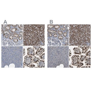 Anti-ACBD5 antibody produced in rabbit Prestige Antibodies&#174; Powered by Atlas Antibodies, affinity isolated antibody, buffered aqueous glycerol solution