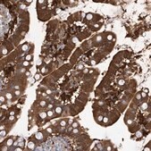 Anti-FABP2 antibody produced in rabbit Prestige Antibodies&#174; Powered by Atlas Antibodies, affinity isolated antibody, buffered aqueous glycerol solution