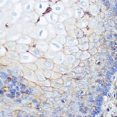 Anti-beta 2 Microglobulin Antibody, clone 5F0O7, Rabbit Monoclonal