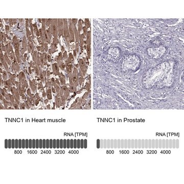 Anti-TNNC1 antibody produced in rabbit Prestige Antibodies&#174; Powered by Atlas Antibodies, affinity isolated antibody