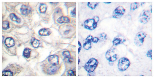 Anti-BAD (Cleaved-Asp71) antibody produced in rabbit affinity isolated antibody