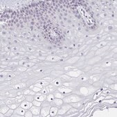 Anti-CACNA1S antibody produced in rabbit Prestige Antibodies&#174; Powered by Atlas Antibodies, affinity isolated antibody, buffered aqueous glycerol solution