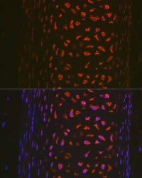 Anti- MMP13 antibody produced in rabbit