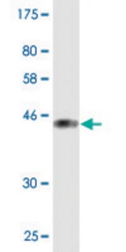 Monoclonal Anti-PIP5K1C, (C-terminal) antibody produced in mouse clone 2E9, purified immunoglobulin, buffered aqueous solution