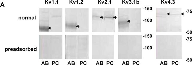 Anti-Potassium Channel Kv3.1b Antibody Chemicon&#174;, from rabbit