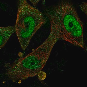 Anti-FBXO32 antibody produced in rabbit Prestige Antibodies&#174; Powered by Atlas Antibodies, affinity isolated antibody