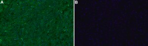Anti-MYH6 Antibody, clone 1L5 ZooMAb&#174; Rabbit Monoclonal recombinant, expressed in HEK 293 cells