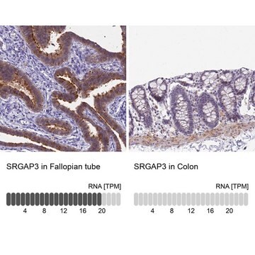 Anti-SRGAP3 antibody produced in rabbit Prestige Antibodies&#174; Powered by Atlas Antibodies, affinity isolated antibody, buffered aqueous glycerol solution