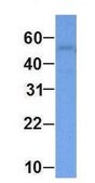 Anti-ABAT antibody produced in rabbit affinity isolated antibody
