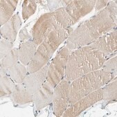 Anti-RPS6KA1 antibody produced in rabbit Prestige Antibodies&#174; Powered by Atlas Antibodies, affinity isolated antibody, buffered aqueous glycerol solution