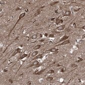 Anti-FOXRED2 antibody produced in rabbit Prestige Antibodies&#174; Powered by Atlas Antibodies, affinity isolated antibody, buffered aqueous glycerol solution, ab1
