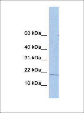 Anti-ZNHIT3 antibody produced in rabbit affinity isolated antibody