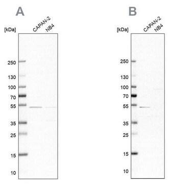 Anti-SPTLC1 antibody produced in rabbit Prestige Antibodies&#174; Powered by Atlas Antibodies, affinity isolated antibody