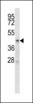 ANTI-ZDHHC6 (C-TERM) antibody produced in rabbit IgG fraction of antiserum, buffered aqueous solution