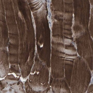 Anti-APOBEC2 antibody produced in rabbit Prestige Antibodies&#174; Powered by Atlas Antibodies, affinity isolated antibody, buffered aqueous glycerol solution