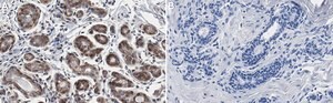 Anti-IGF-1R β Antibody, clone 1D18 ZooMAb&#174; Rabbit Monoclonal recombinant, expressed in HEK 293 cells