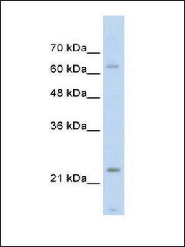 Anti-TNNI1 (AB2) antibody produced in rabbit IgG fraction of antiserum