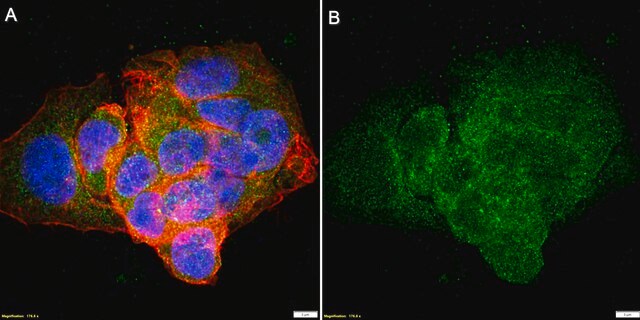 Anti-HSD17B13 Antibody, clone 2B3 ZooMAb&#174; Rabbit Monoclonal recombinant, expressed in HEK 293 cells