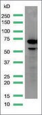 Anti-Alpha-Fetoprotein antibody, Rabbit monoclonal recombinant, expressed in proprietary host, clone SP154, affinity isolated antibody