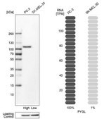 Anti-PYGL antibody produced in rabbit Prestige Antibodies&#174; Powered by Atlas Antibodies, affinity isolated antibody, buffered aqueous glycerol solution